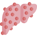 Liver Cirrhosis