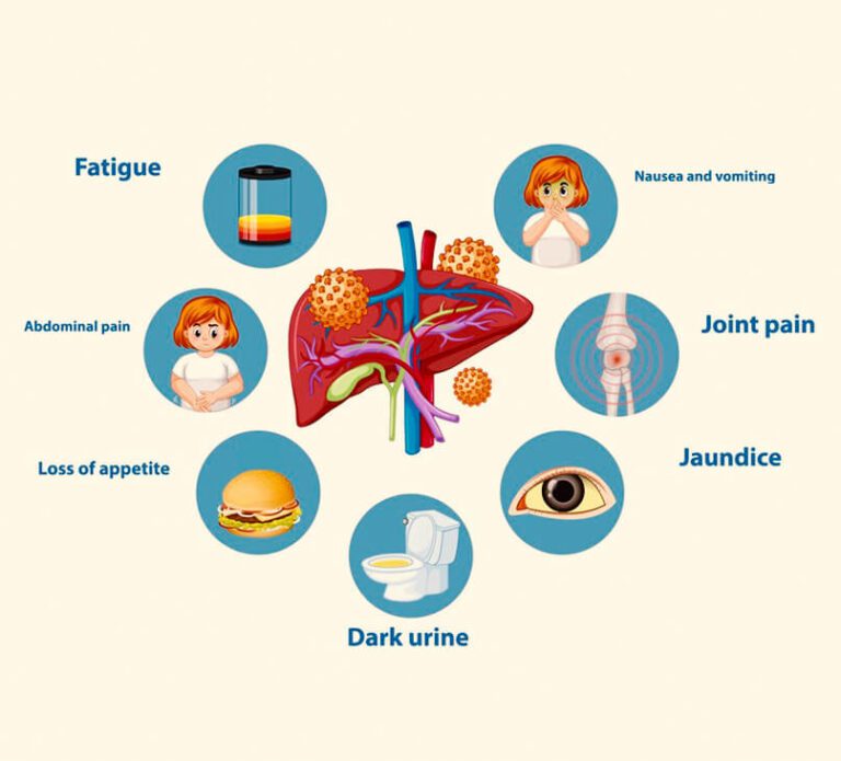 common-symptoms-hepatitis-b