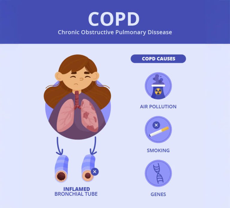 flat-hand-drawn-copd-infographic