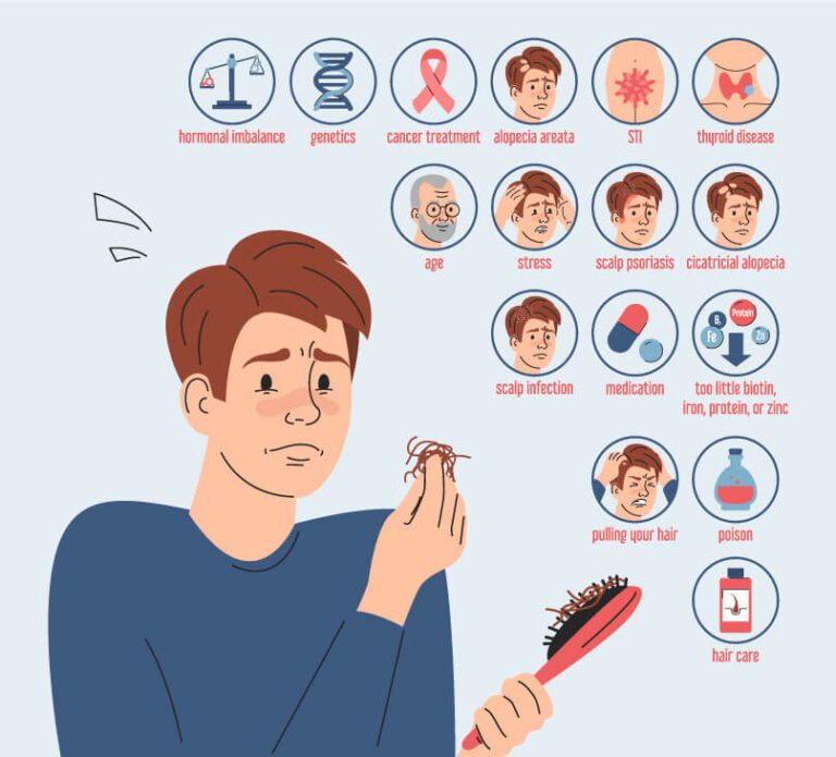 hair-loss-causes-malef