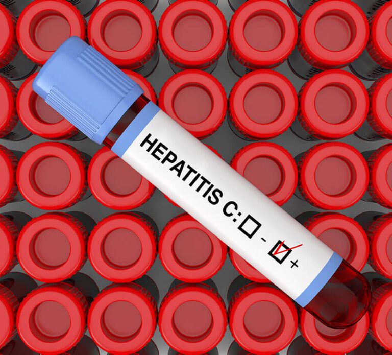 Homeopathic Treatment for Hepatitis C