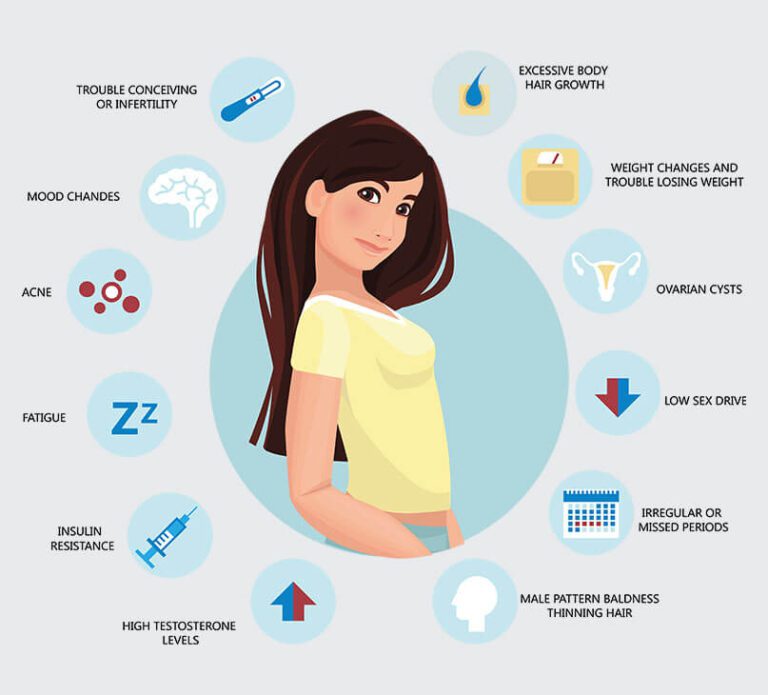 Symptoms of PCOD/PCOS