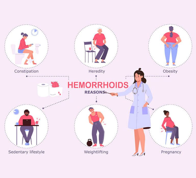 Causes of Haemorrhoids