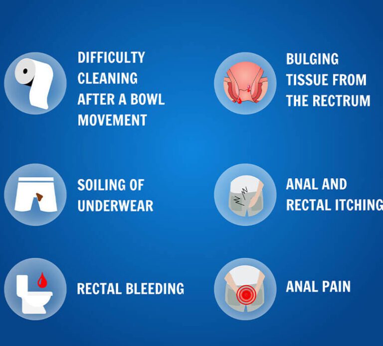 Symptoms of Haemorrhoids