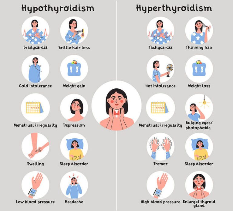 Symptoms of Thyroid Disorders