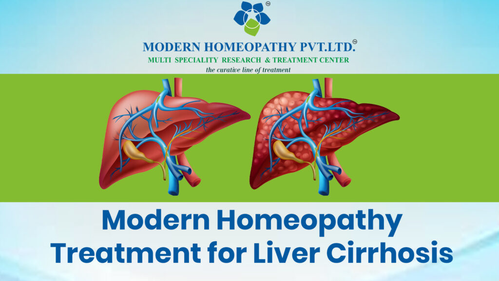 Liver Cirrhosis Recovery without Surgery: Modern Homeopathy Treatment offers a Transplant-Free Solution