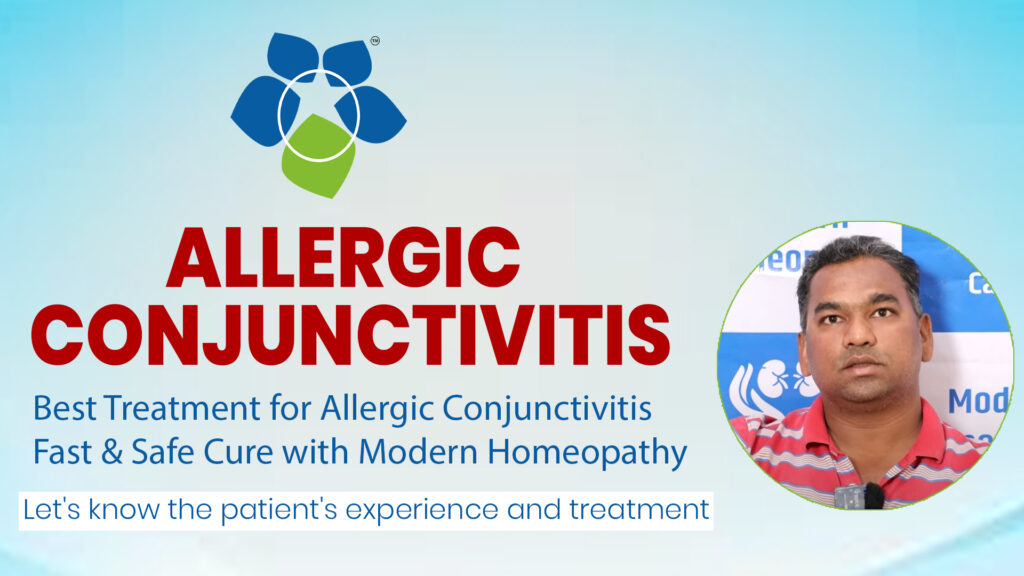 Best Treatment for Allergic Conjunctivitis | Fast & Safe Cure with Modern Homeopathy